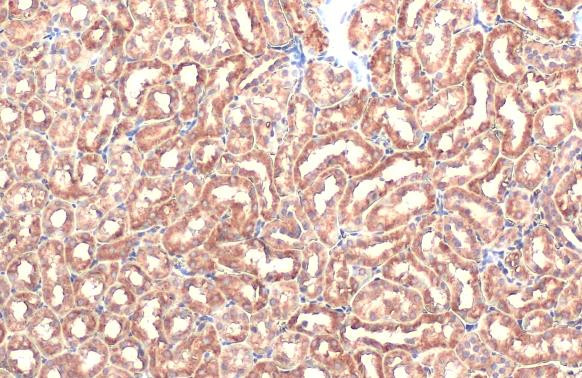 MOX1 Antibody in Immunohistochemistry (Paraffin) (IHC (P))