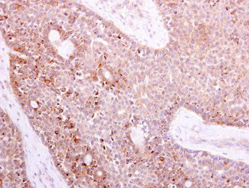 MOX1 Antibody in Immunohistochemistry (Paraffin) (IHC (P))