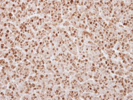 UHRF1 Antibody in Immunohistochemistry (Paraffin) (IHC (P))