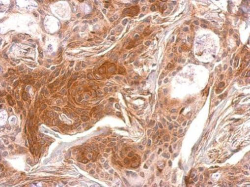 TPK1 Antibody in Immunohistochemistry (Paraffin) (IHC (P))