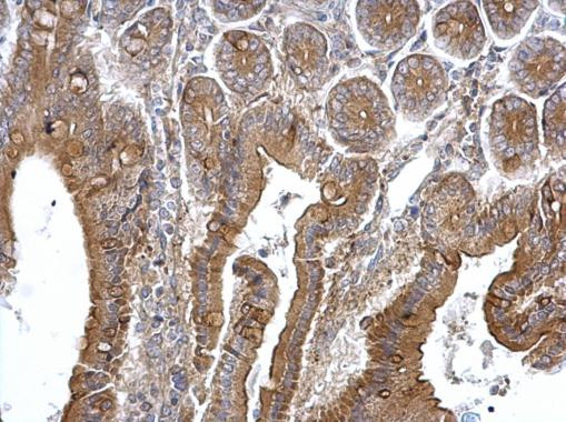 TPK1 Antibody in Immunohistochemistry (Paraffin) (IHC (P))