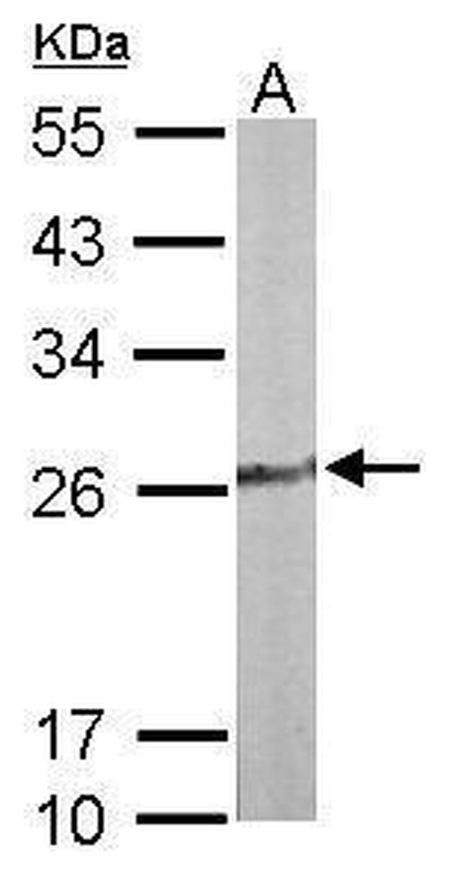 TPK1 Antibody in Western Blot (WB)