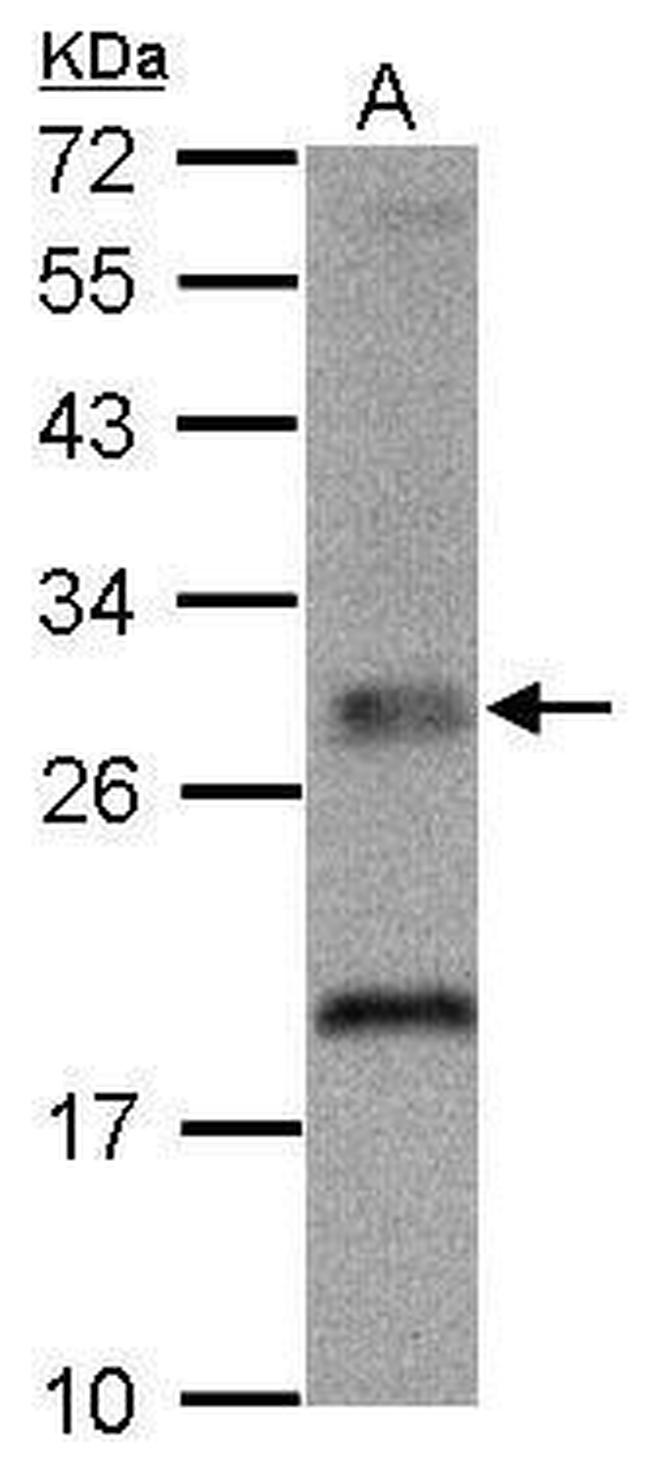 TPK1 Antibody in Western Blot (WB)