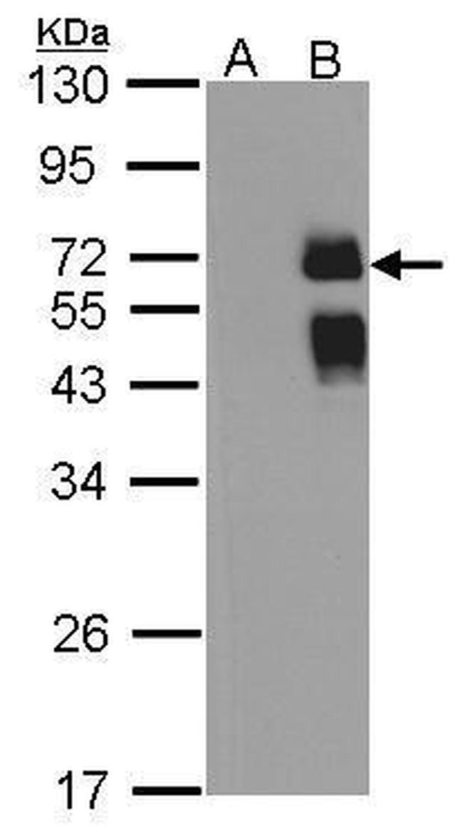 ST6GAL1 Antibody in Western Blot (WB)