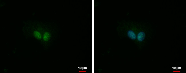 ITPKC Antibody in Immunocytochemistry (ICC/IF)