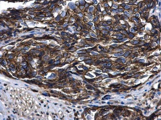 Arfaptin 2 Antibody in Immunohistochemistry (Paraffin) (IHC (P))