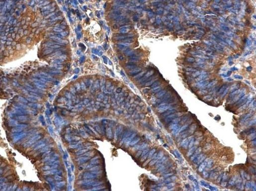 Arfaptin 2 Antibody in Immunohistochemistry (Paraffin) (IHC (P))