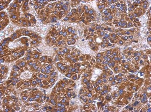 C4BPB Antibody in Immunohistochemistry (Paraffin) (IHC (P))