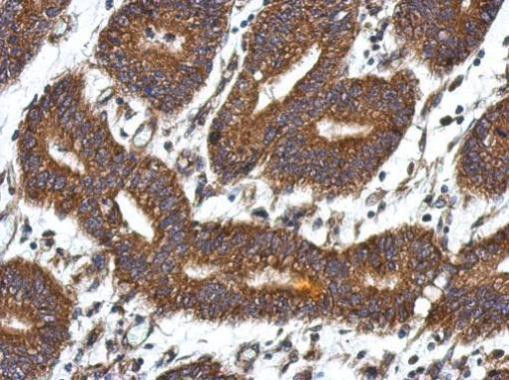 QDPR Antibody in Immunohistochemistry (Paraffin) (IHC (P))