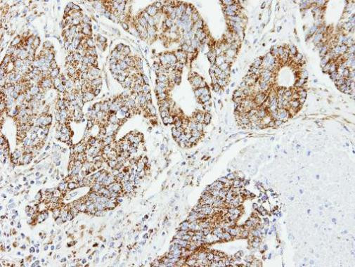 DCI Antibody in Immunohistochemistry (Paraffin) (IHC (P))