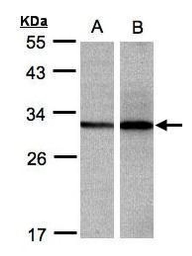 DCI Antibody in Western Blot (WB)