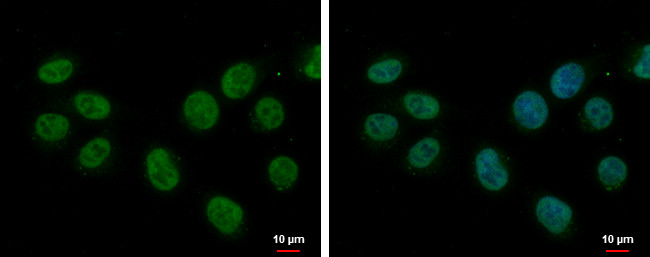 SF1 Antibody in Immunocytochemistry (ICC/IF)