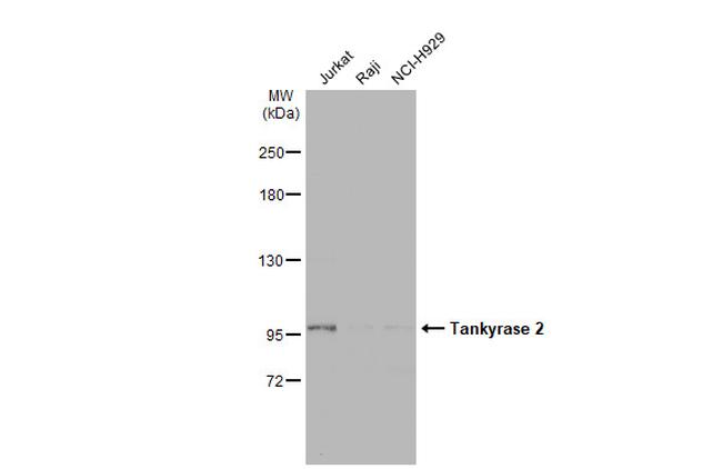 Tankyrase 2 Antibody in Western Blot (WB)