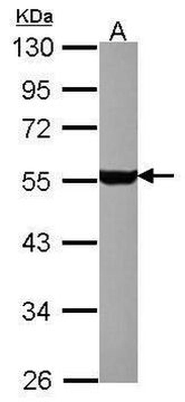 HTR1A Antibody in Western Blot (WB)