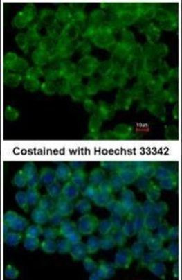 PODXL Antibody in Immunocytochemistry (ICC/IF)