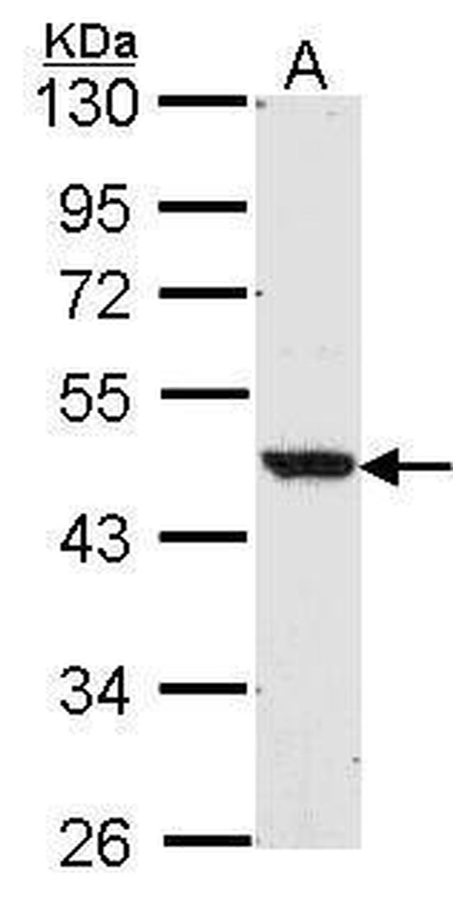 LXR beta Antibody in Western Blot (WB)