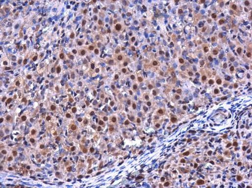 RGS2 Antibody in Immunohistochemistry (Paraffin) (IHC (P))