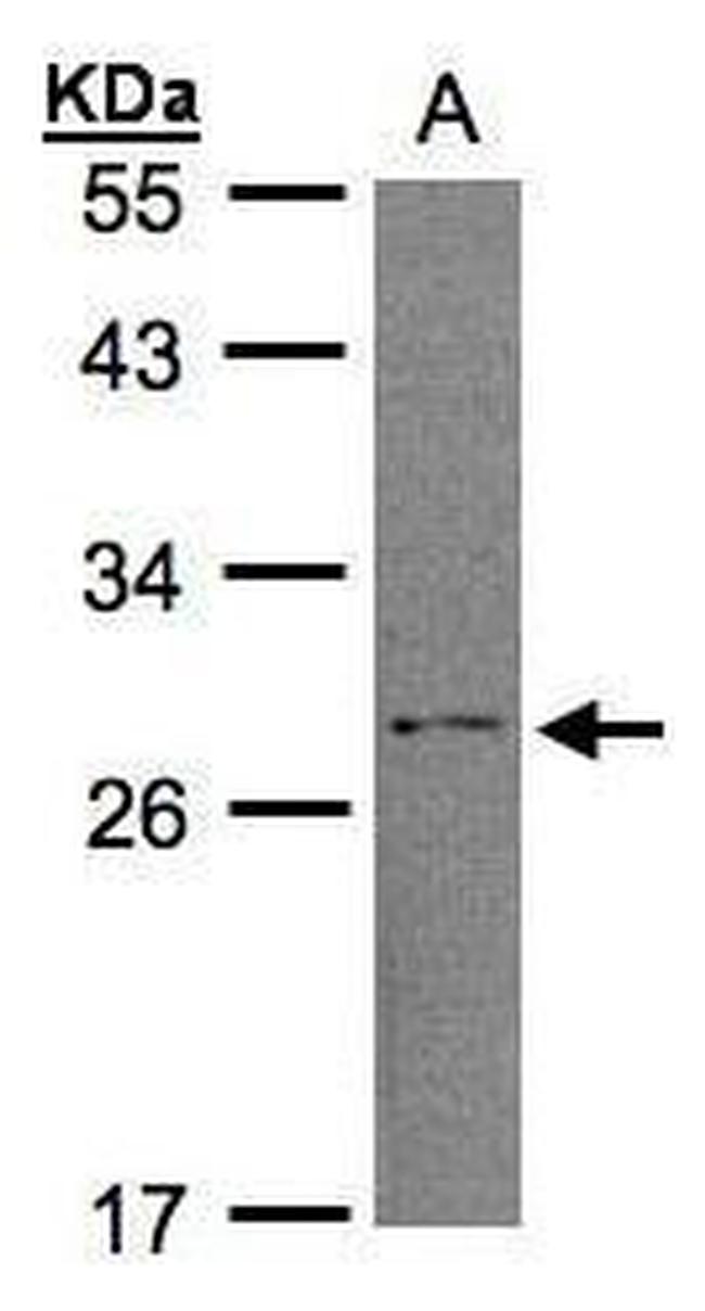 RGS2 Antibody in Western Blot (WB)