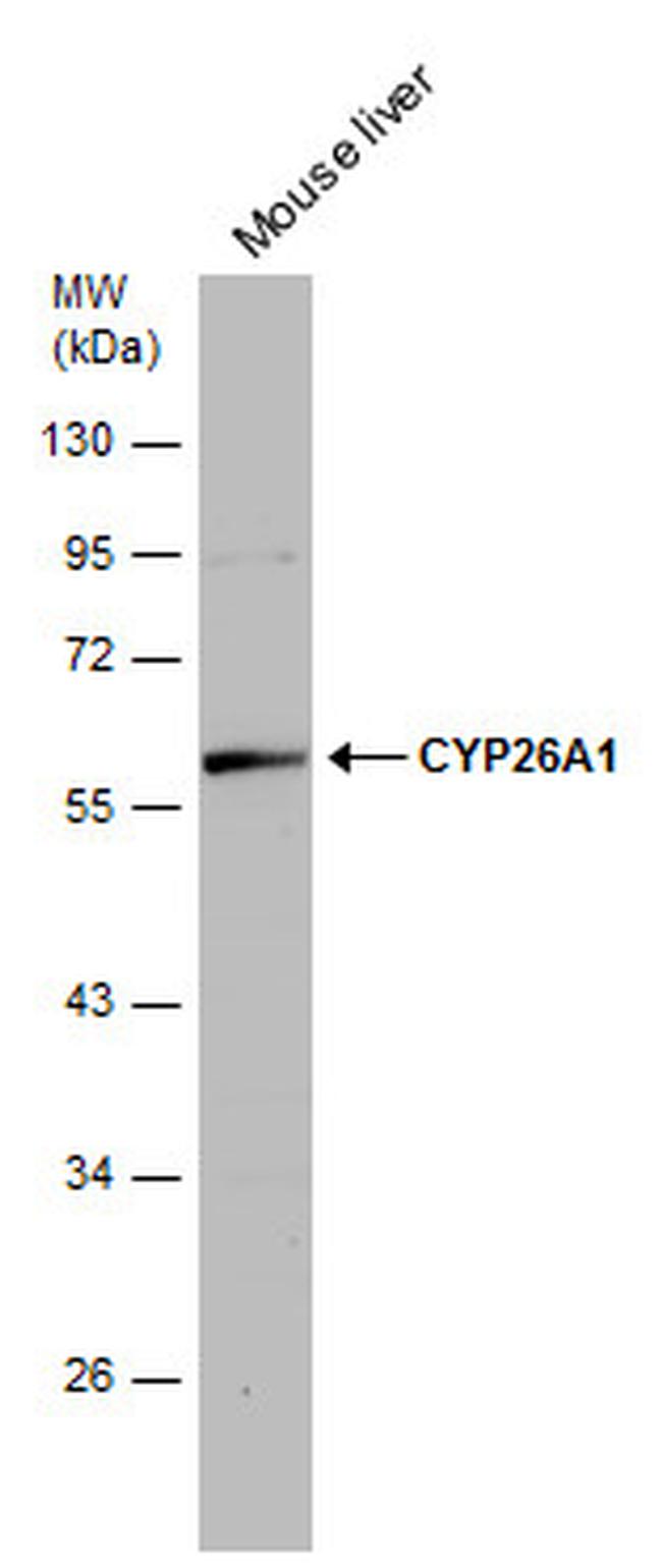 CYP26A1 Antibody in Western Blot (WB)