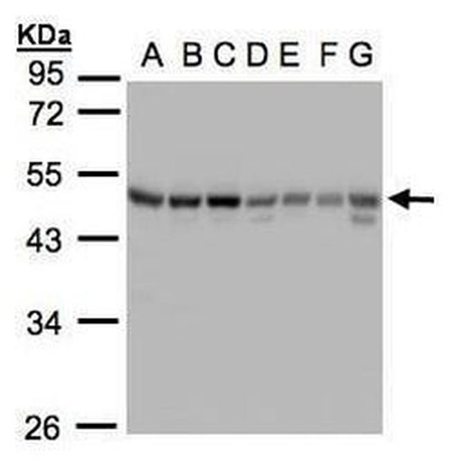 GABRB1 Antibody in Western Blot (WB)