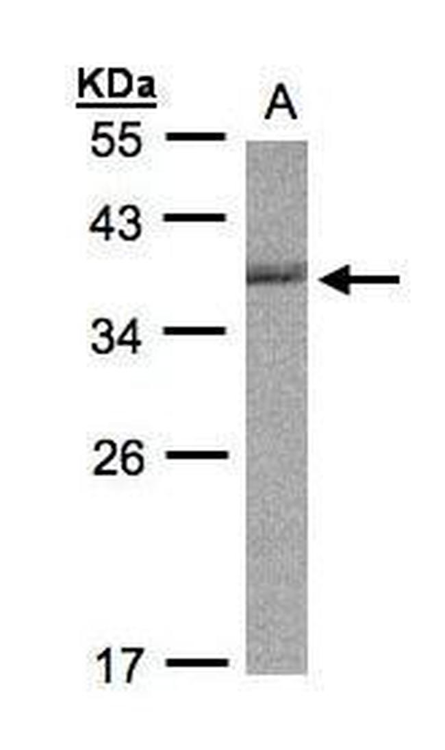 Cdc34 Antibody in Western Blot (WB)