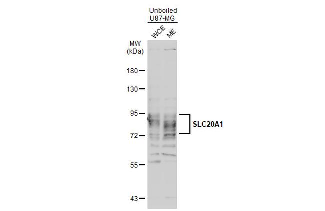 SLC20A1 Antibody in Western Blot (WB)