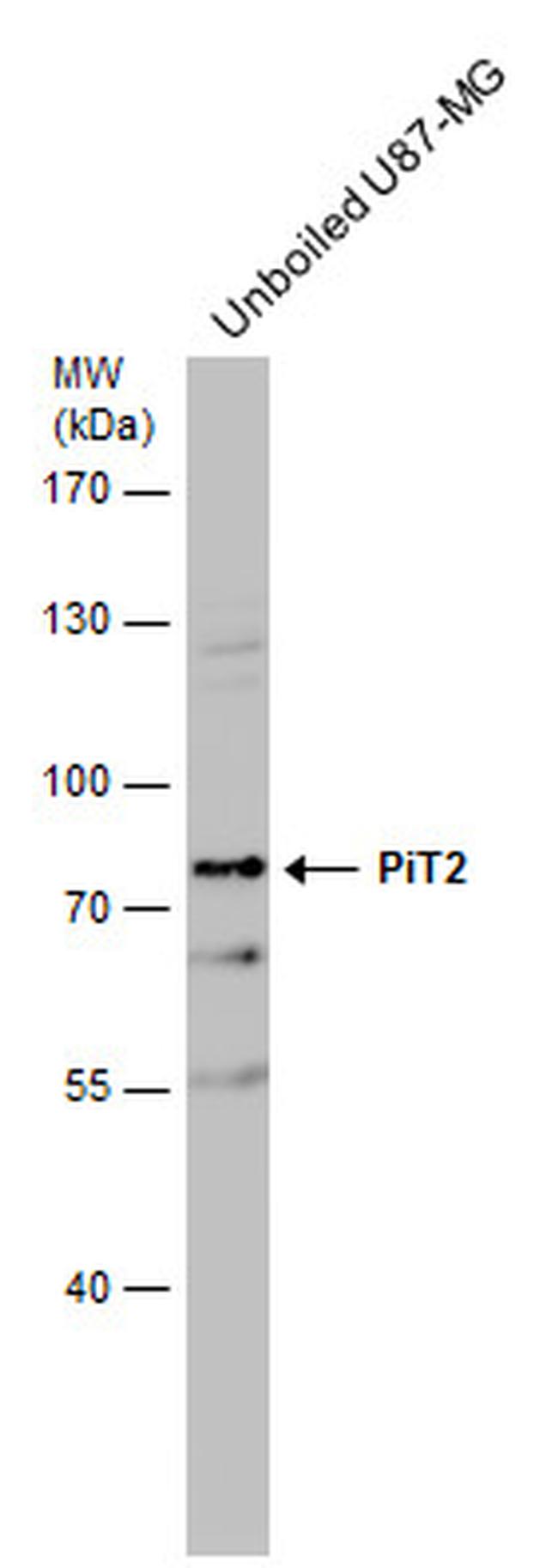 SLC20A2 Polyclonal Antibody (PA5-28184)