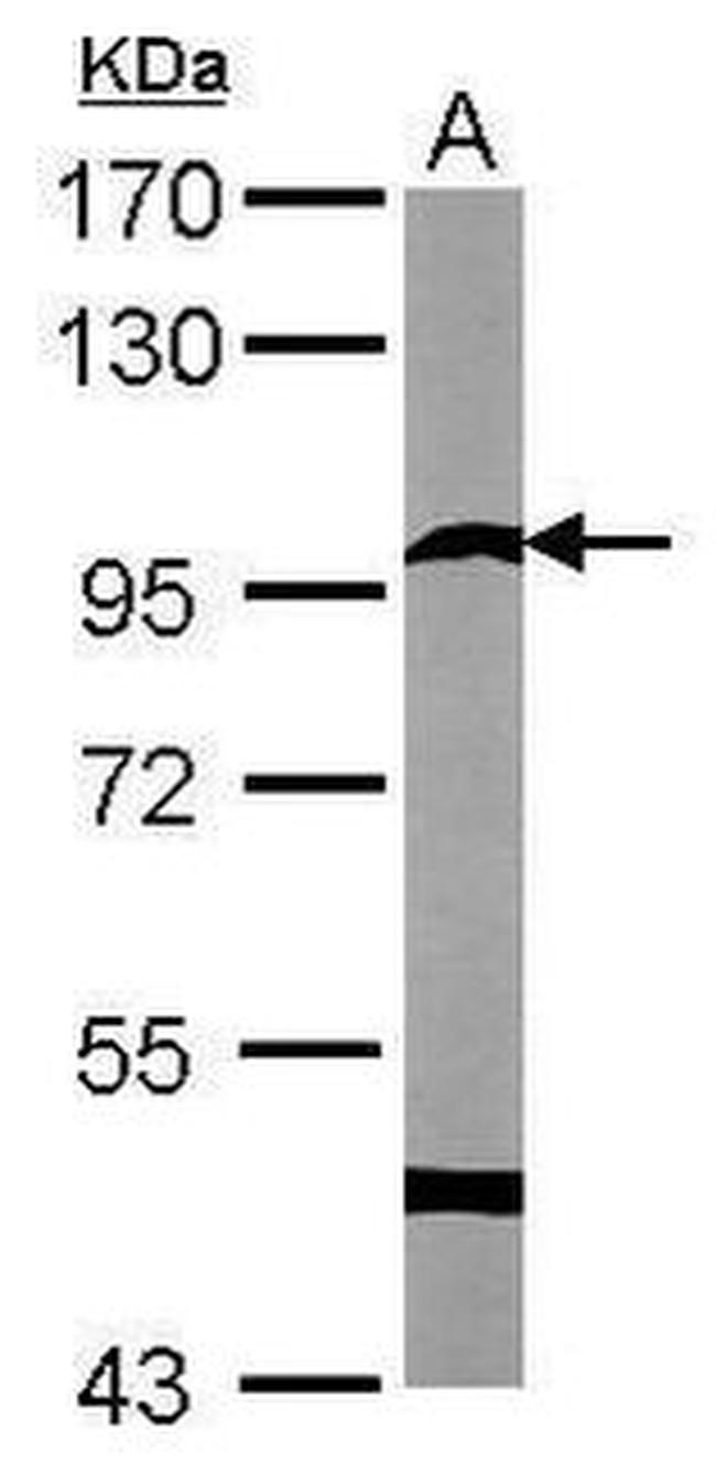 SEMA6A Antibody in Western Blot (WB)