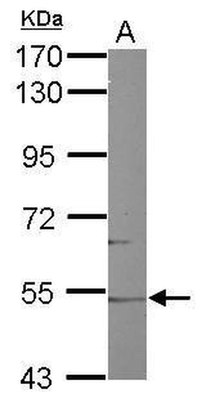 Cyp46a1 Antibody in Western Blot (WB)