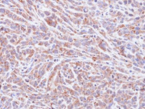 PP1 alpha Antibody in Immunohistochemistry (Paraffin) (IHC (P))