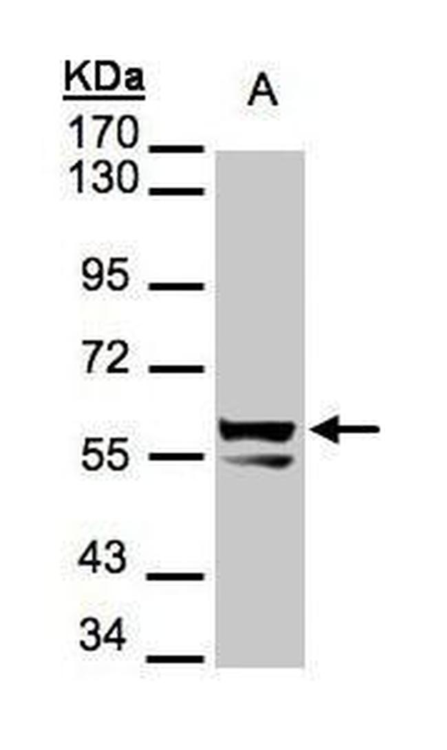 Cytokeratin 6 Antibody in Western Blot (WB)