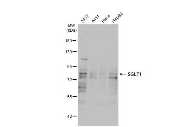 SGLT1 Antibody in Western Blot (WB)