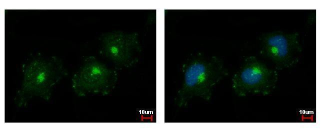 C1S Antibody in Immunocytochemistry (ICC/IF)