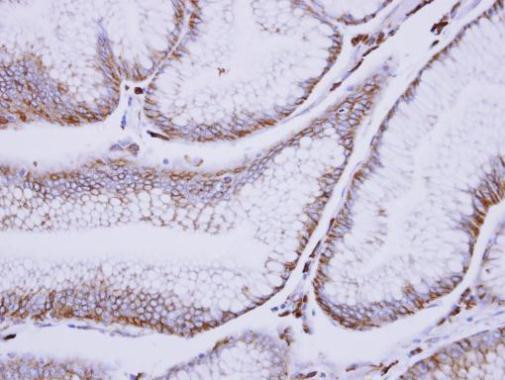 C1S Antibody in Immunohistochemistry (Paraffin) (IHC (P))