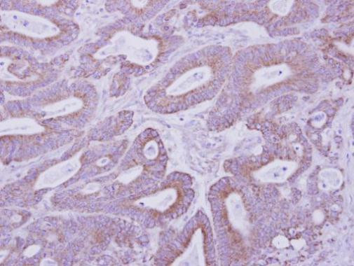 PRKAR2B Antibody in Immunohistochemistry (Paraffin) (IHC (P))