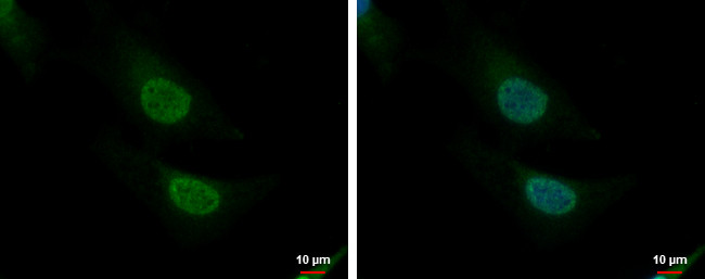 CNOT8 Antibody in Immunocytochemistry (ICC/IF)