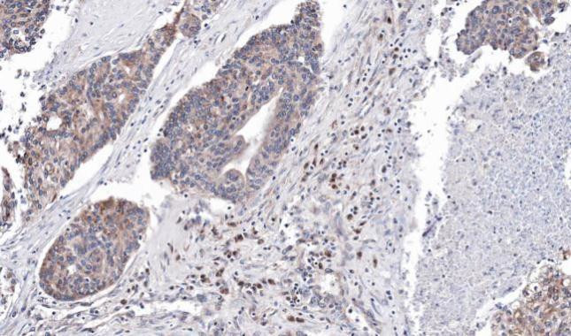 DRIL1 Antibody in Immunohistochemistry (Paraffin) (IHC (P))