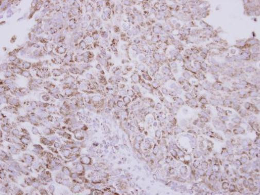 Protein C Antibody in Immunohistochemistry (Paraffin) (IHC (P))