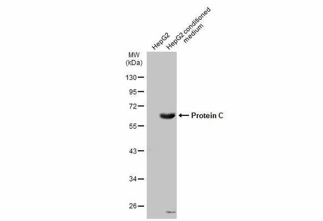 Protein C Antibody in Western Blot (WB)