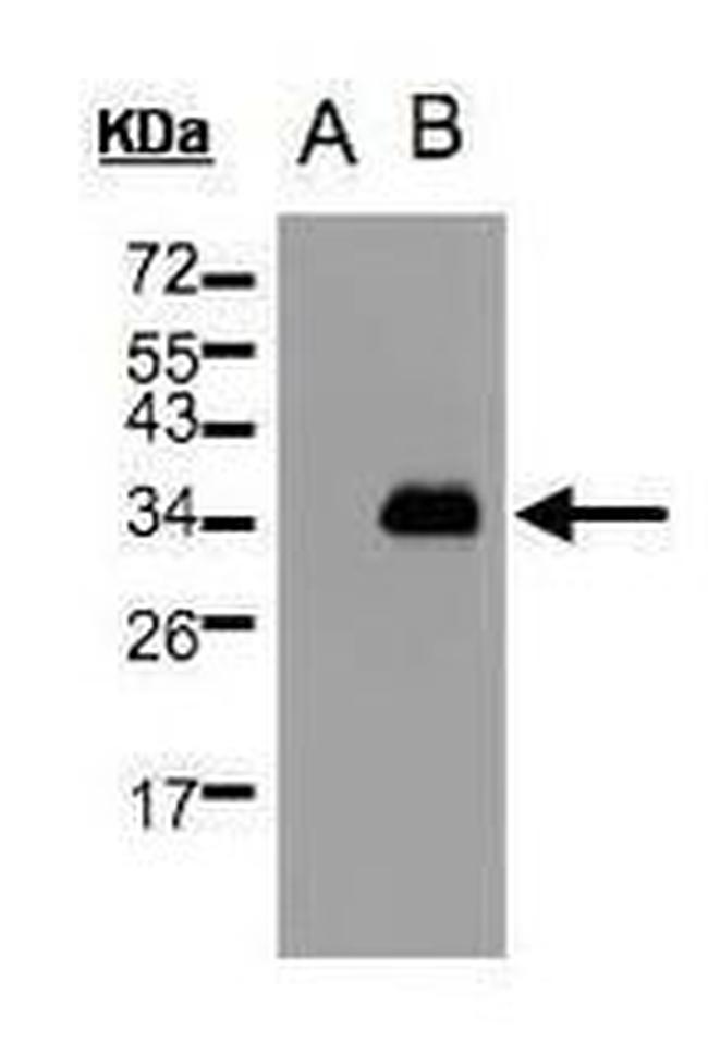 KChIP3 Antibody in Western Blot (WB)