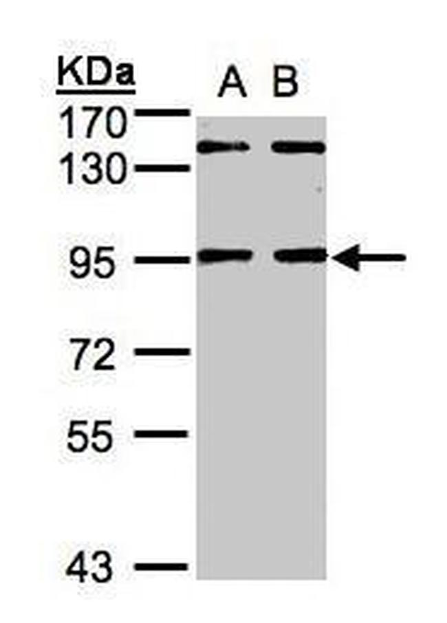 DCAF6 Antibody in Western Blot (WB)