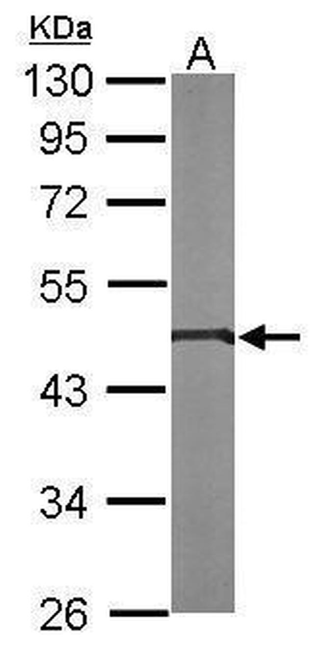 PIGK Antibody in Western Blot (WB)