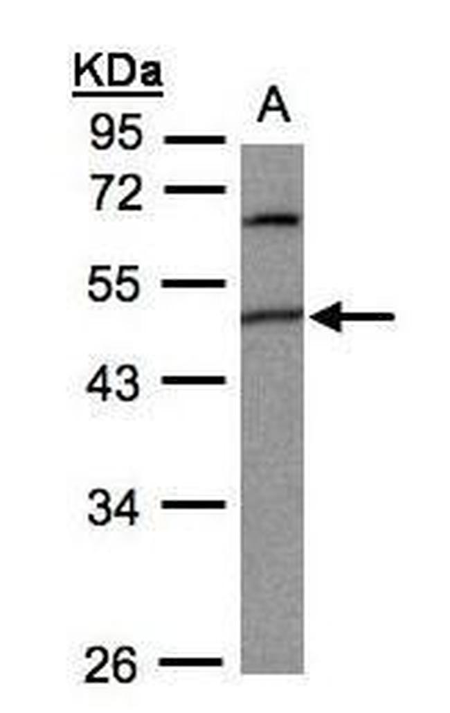 PIGK Antibody in Western Blot (WB)