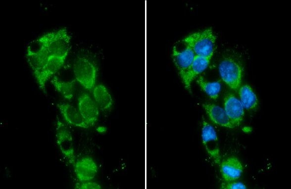 Monoamine Oxidase B Antibody in Immunocytochemistry (ICC/IF)