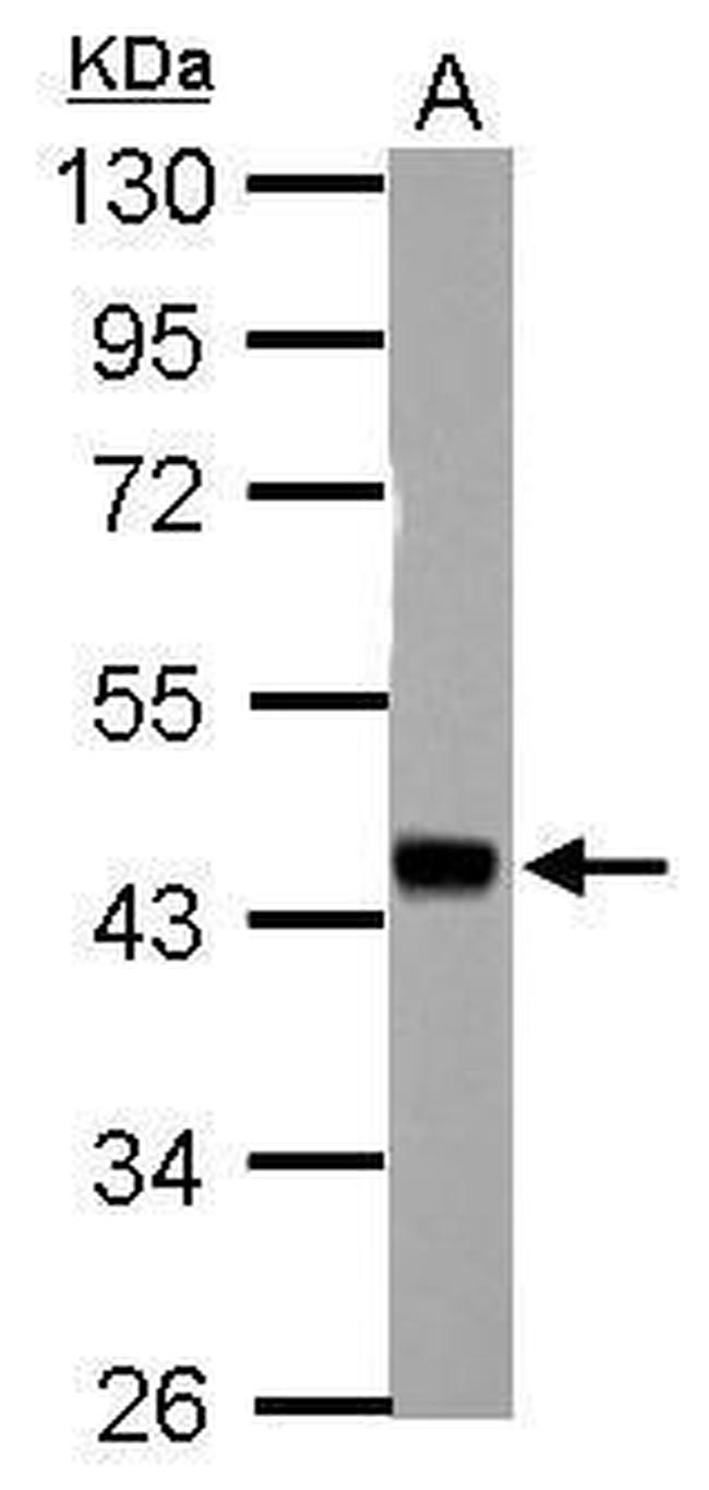 HSFY1/HSFY2 Antibody in Western Blot (WB)