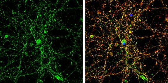 GLRA1 Antibody in Immunocytochemistry (ICC/IF)