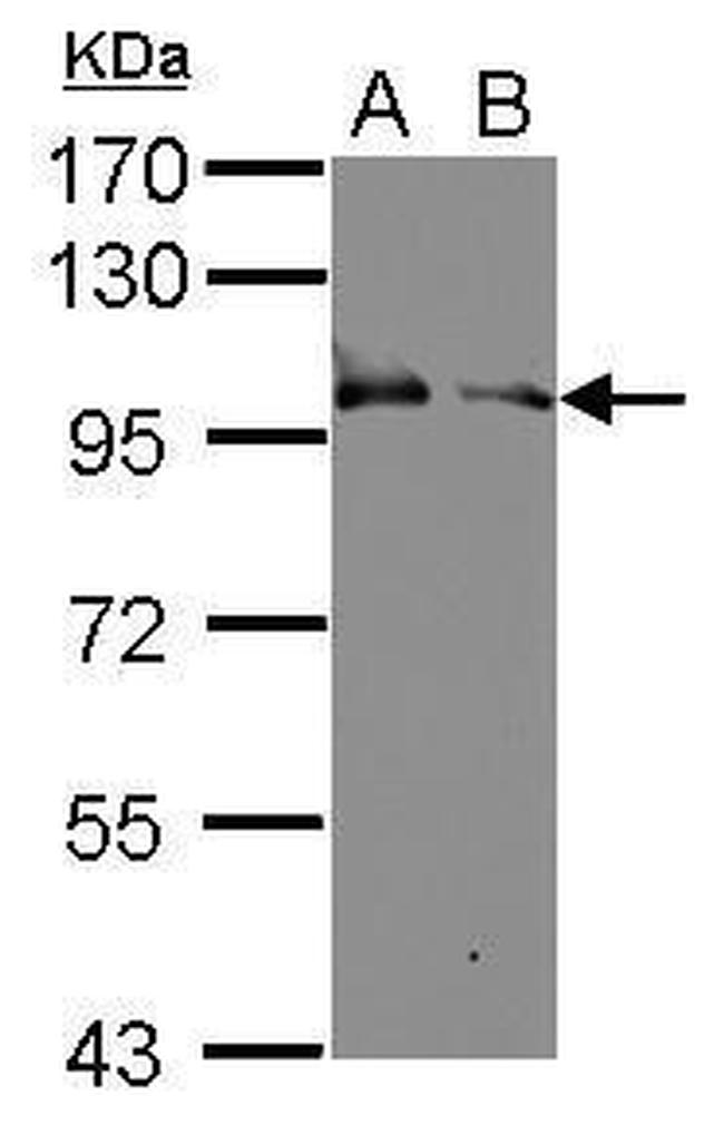 KELL Antibody in Western Blot (WB)