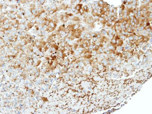 WNK1 Antibody in Immunohistochemistry (Paraffin) (IHC (P))