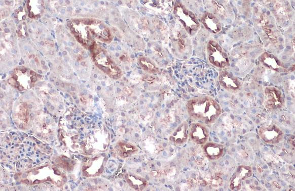 WNK1 Antibody in Immunohistochemistry (Paraffin) (IHC (P))