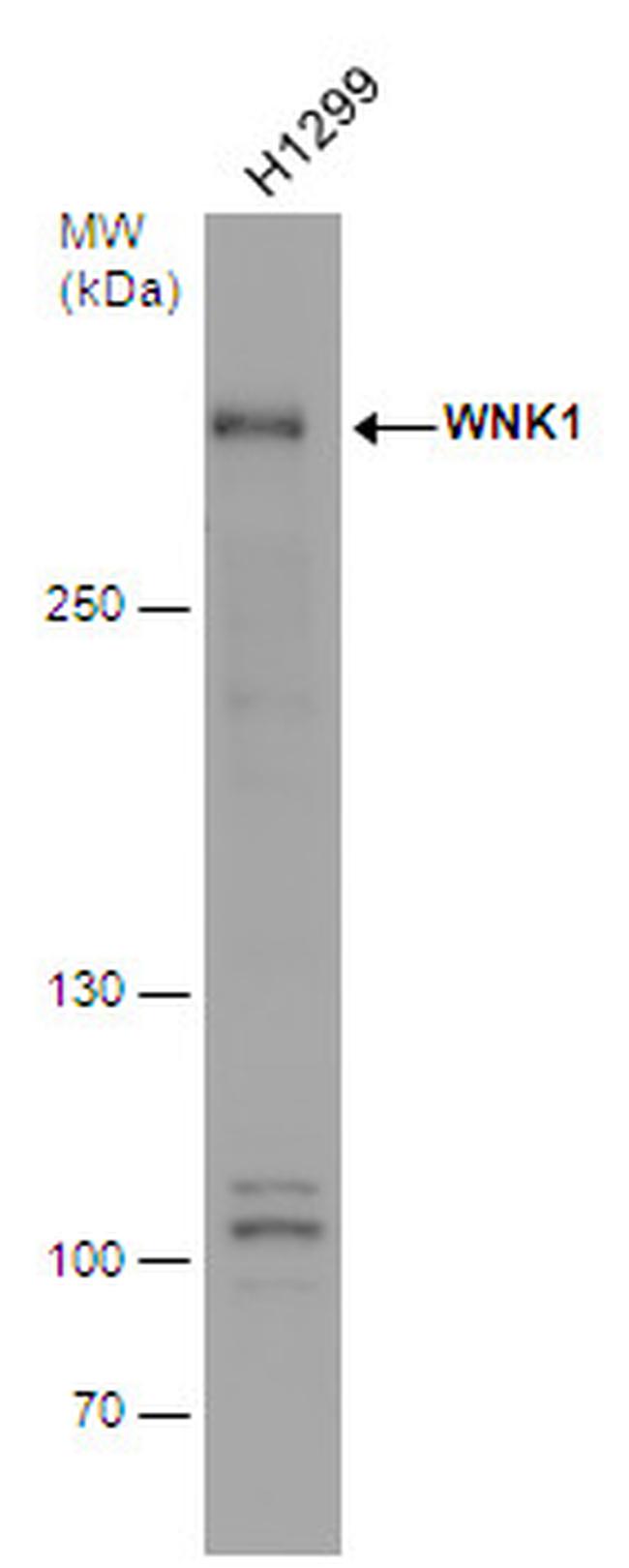 WNK1 Antibody in Western Blot (WB)